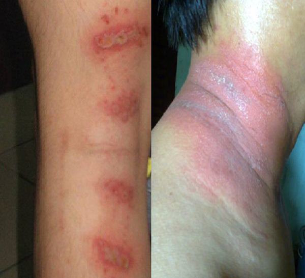 Cách đơn giản đuổi kiến ba khoang ra khỏi nhà vĩnh viễn, ở chung cư nên học hỏi ngay